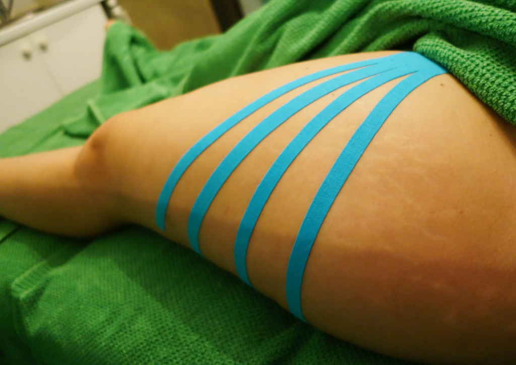 Taping linfatico